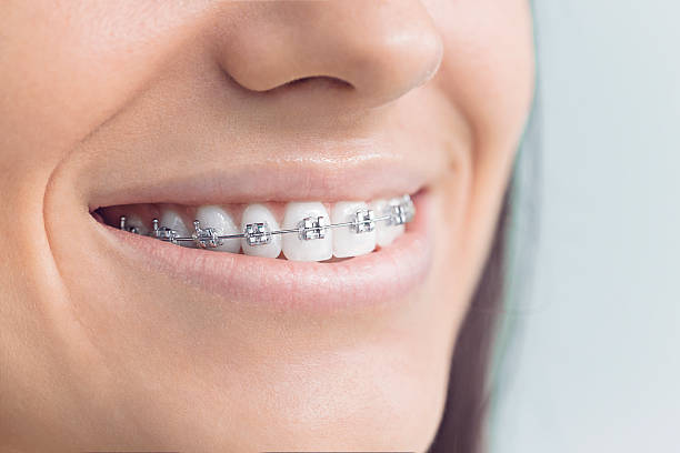 Best Wisdom Tooth Removal  in Gordonsville, VA